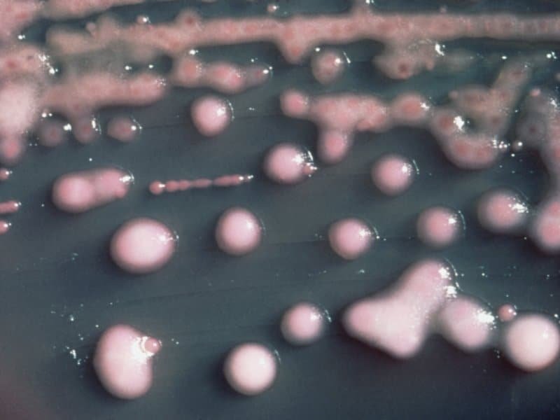 la bacteria Klebsiella pneumoniae