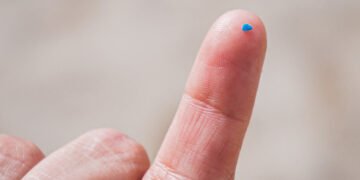 Los microplásticos podrían triplicarse en 2060 incluso con medidas globales – EFEverde