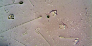 Partículas microscópicas en agua representando la contaminación por microplásticos que los microrobots checos buscan eliminar